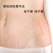 (Little Red Book Recommended) Body leaving no trace of the summer wearing a short dress no longer awkward to buy two and send one