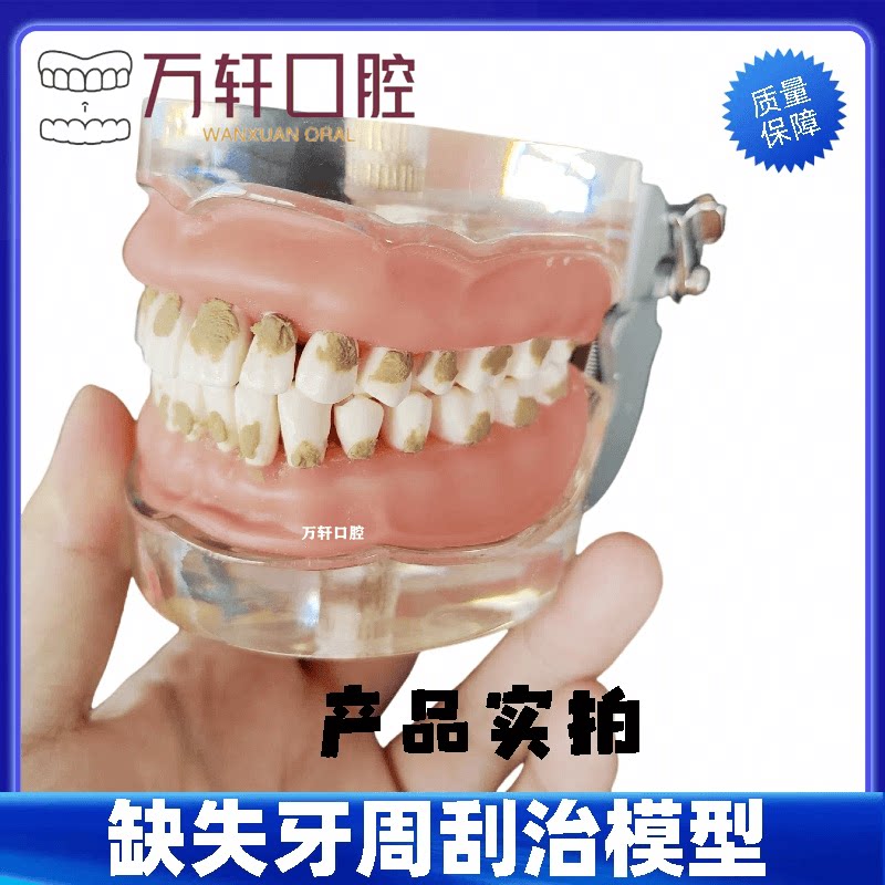 牙科口腔教学模型 牙周病理模型  练习刮治结石 牙周分类医患沟通
