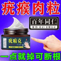 Flat Warts remove anointed paste with a Spirit Face Spirit to wart anatomy cream to remove monkey granules
