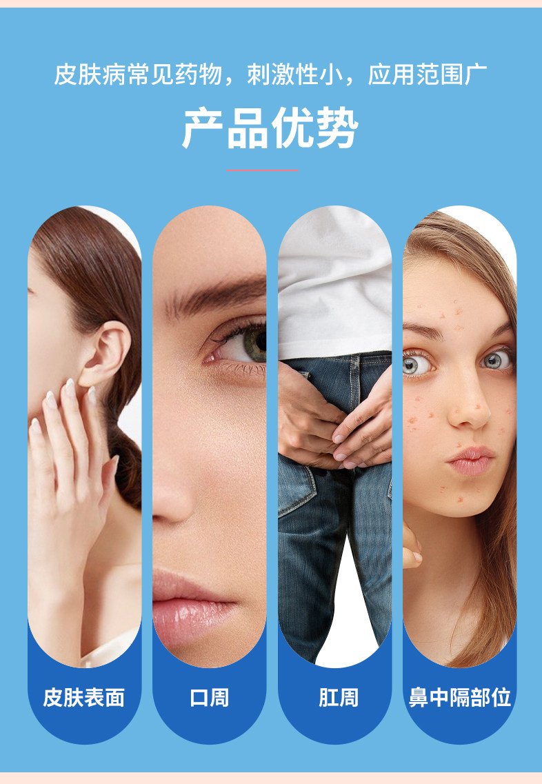 川石   红霉素软膏  抗菌消炎  祛痘 皮炎 烫伤   8g/支