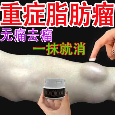 Fatty aneurysm Subcutaneous Fat Tumor Removal Theologer Removes Hard Lump Lump Single Hair Multiple Anti-Tumor Patch