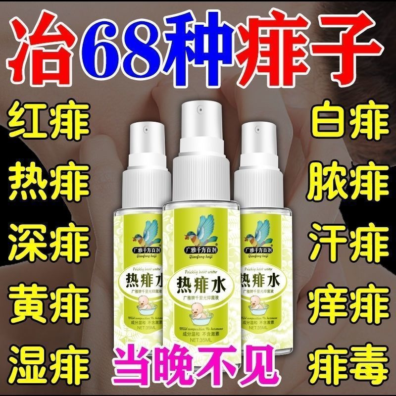 Hot prickly heat water red rash pustule children adult general antibacterial anti-prickly heat anti-itch spray special effect prickly heat water dispelling prickly heat nemesis