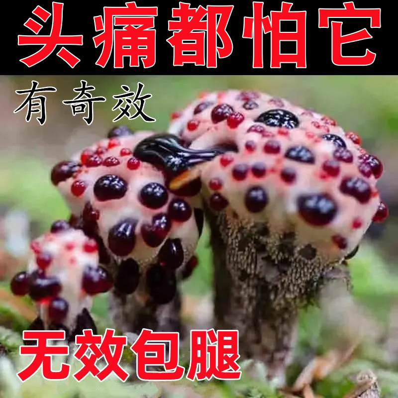 (Special Effects Headache Cream) Headache Headache Cream Migraine Intractable Headache Special Relieving Thever LJ 