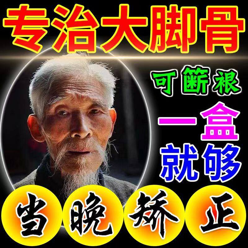 100% Success Rate) Severe Thumb Valgus Patch Paste Special Medicine Big Foot Bone Orthotic Foot Finger Valgus Deformity JN 