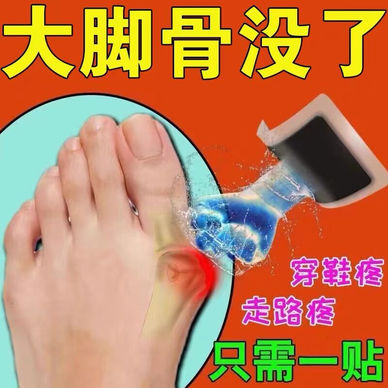 Hallux Cystitis Pain Thumb Valgus Paste With Large Footed Bone Valgus Toe Pain Deformity Swollen Correction Special Patch ZY 