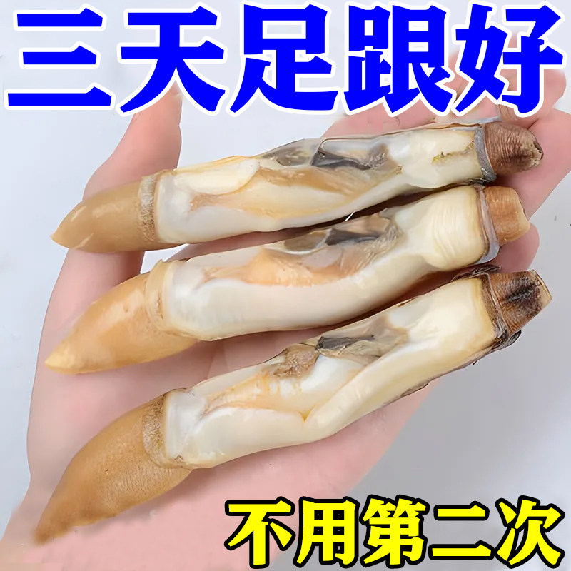 (Three Days of Metallurgical Good) Foot Heel Pain Special Paste Cream Heel Pain Walking Foot Bottom Plate Ligament Pull Injera YF-Taobao