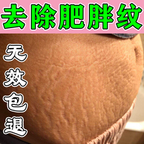 Obesity mark removal ointment specializes in treating hormone marks during pregnancy stretch marks expansion marks fades scars and is the nemesis of growth marks on thighs