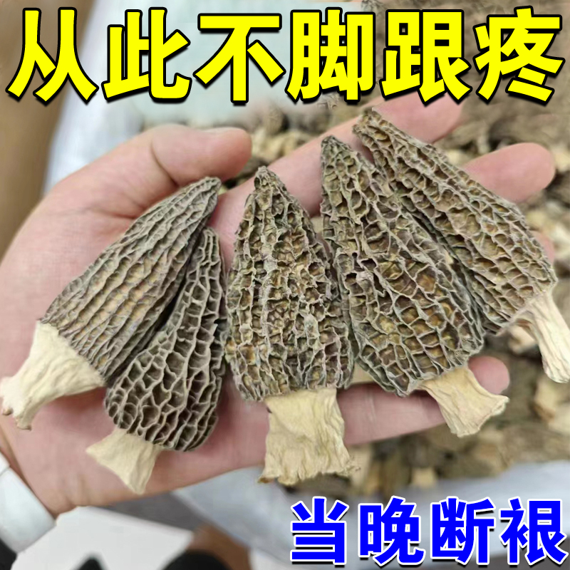 Heel pain (fastest three days) heel pain heel tendinitis heel ligament pull injury heel pain special post SL-Taobao