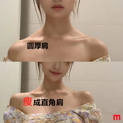 (Recommended by Jiaqi) Beautiful shoulder artifact right-angled shoulders away from thick shoulders