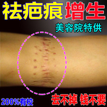 Remove scars hyperplasia pimples raised chest scars perms and burns caesarean section double eyelid surgery repair cream
