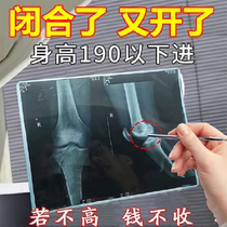 Buy 4 and get 5 free. Height-increasing tool. Quickly grow 3-15 cm. Unisex for men and women aged 6-48. Help you get rid of your worries.