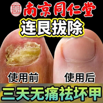 The effect is great (refundable if not used). Just drop a drop of it and the bad nails will turn into good ones. Use potassium methyl methyl chloride to enjoy a good nail life.