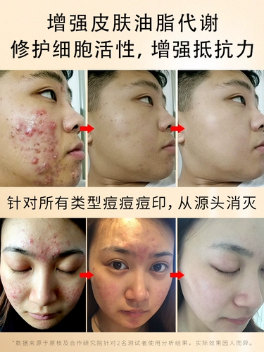 Какими лекарственными лимфатическими узлами являются прыщи на поверхности прыщей на лице неоднократно на лице