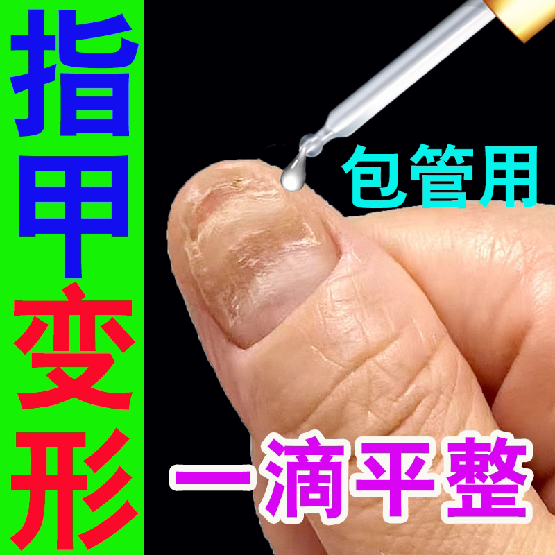 Nail Repair Growth Solution for Deformed Nails, Uneven Nails, Nail Biting, Repair and Correction of Damaged Nails, Regrowth and Nail Bed Care