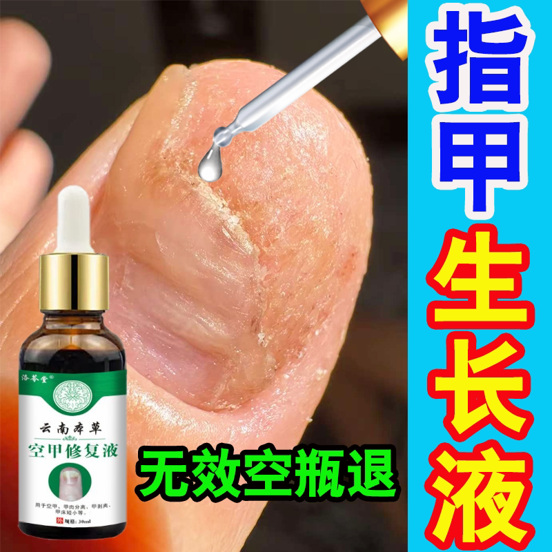 Nail Repair Growth Solution for Nail Recession, Unevenness, Biting of the Nail Bed, Regenerating and Promoting Nail Growth Solution