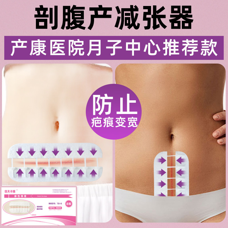剖腹产减张贴佳夫卡瑞免缝愈合贴疤痕抑增生套餐8扣减张器
