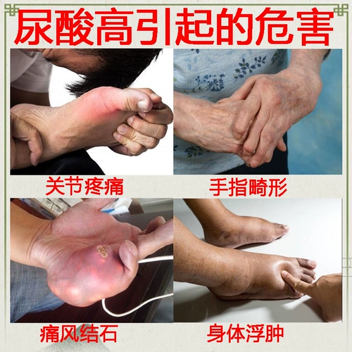 [Импортировано в Японии] подагра Специальные эффекты Медицина Артроцитарная Снижение боли Специальные эффекты Медицина лечение подагра сжатие новая версия.