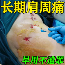 Shoulder pain shoulder pain special elimination ointment shoulder pain shoulder neck and back pain numbness stiff shoulder support