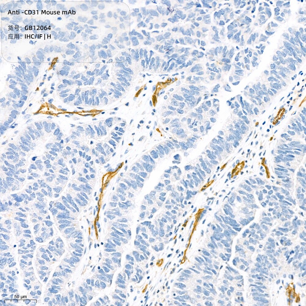Servicebio抗-CD31小鼠单克隆抗体,适用IHC/IF,种属H,白细胞抗原