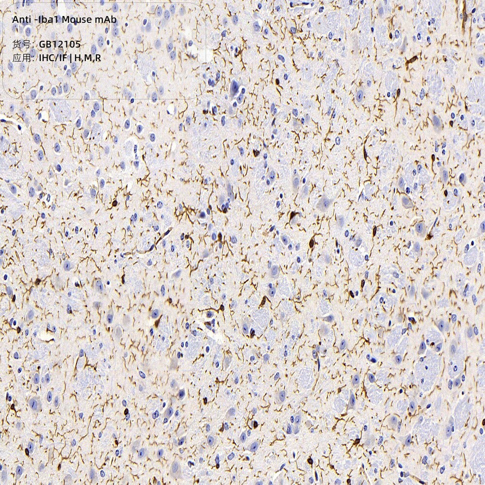 Servicebio抗-Iba1小鼠单克隆抗体,适用IHC/IF,应用种属H/M/R/Mk