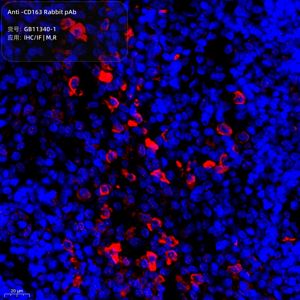 Servicebio抗-CD163兔pAbAnti-CD163 Rabbit pAbGB11340-1,100&mu;L