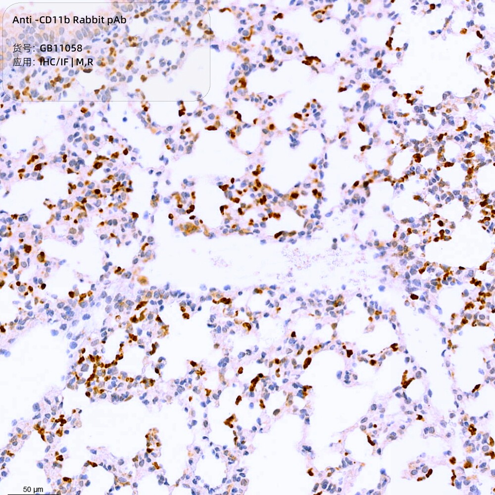 Servicebio抗-CD11b兔pAb抗体,Anti-CD11b Rabbit pAb,适用IHC/IF
