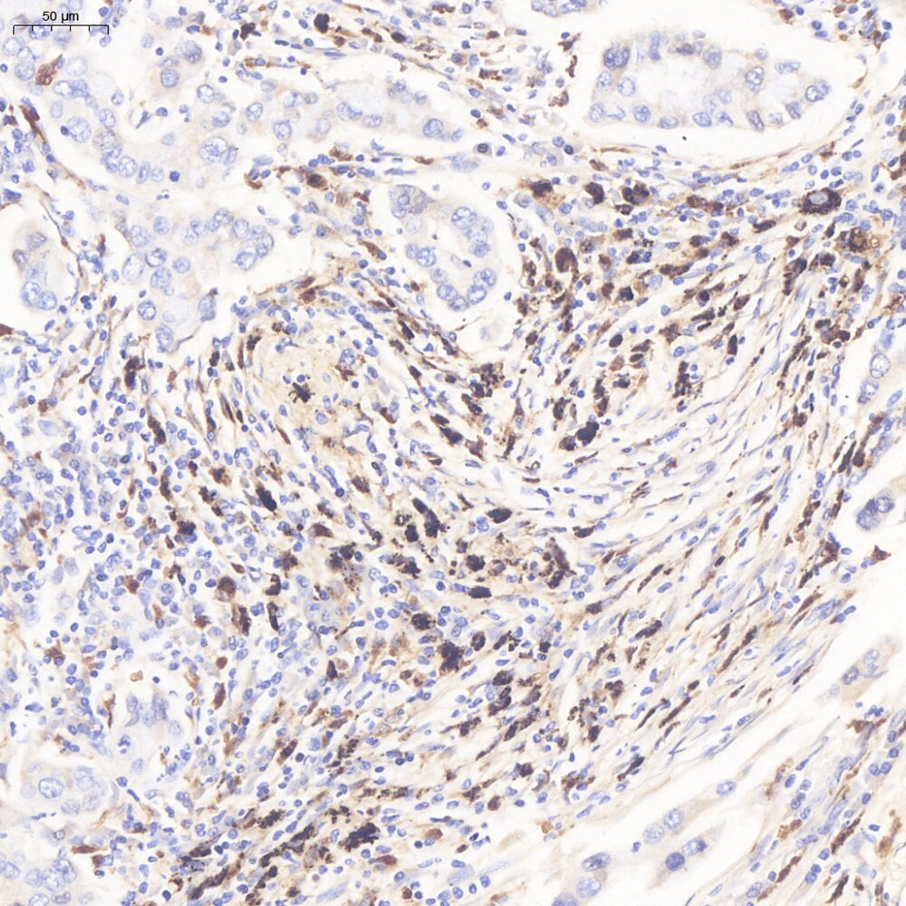 Servicebio抗-CD68兔pAb抗体Anti-CD68 Rabbit pAb适用IHC/IF推荐