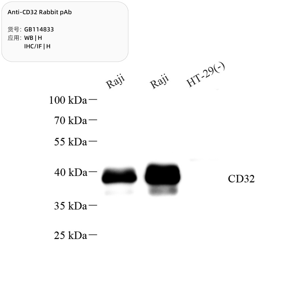 Servicebio抗CD32兔单克隆抗体适用WB/IHC/IF应用种属H白细胞抗原