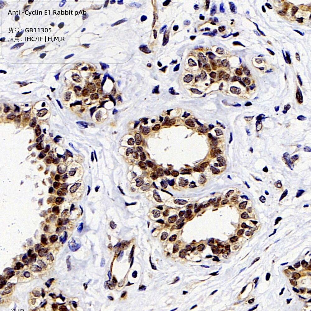 抗细胞周期蛋白E1兔pAb抗体适用IHC/IF种属H/M/R细胞周期推荐抗体