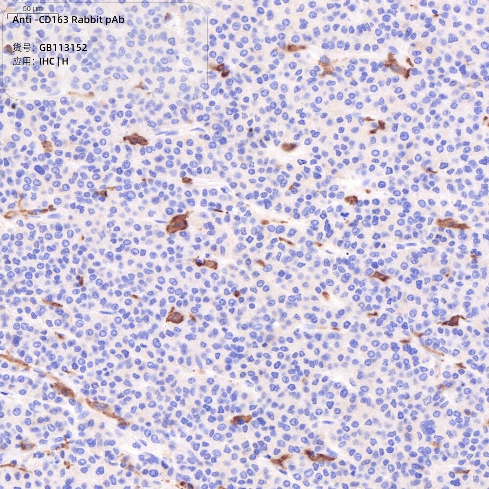 Servicebio抗-CD163兔pAb抗体,Anti-CD163 Rabbit pAb,适用IHC/IF