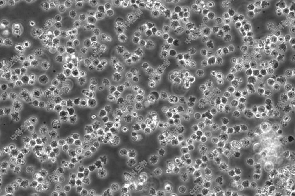 HyCyte?人Burkitt's淋巴瘤细胞（Daudi）用于白血病发生机理研究