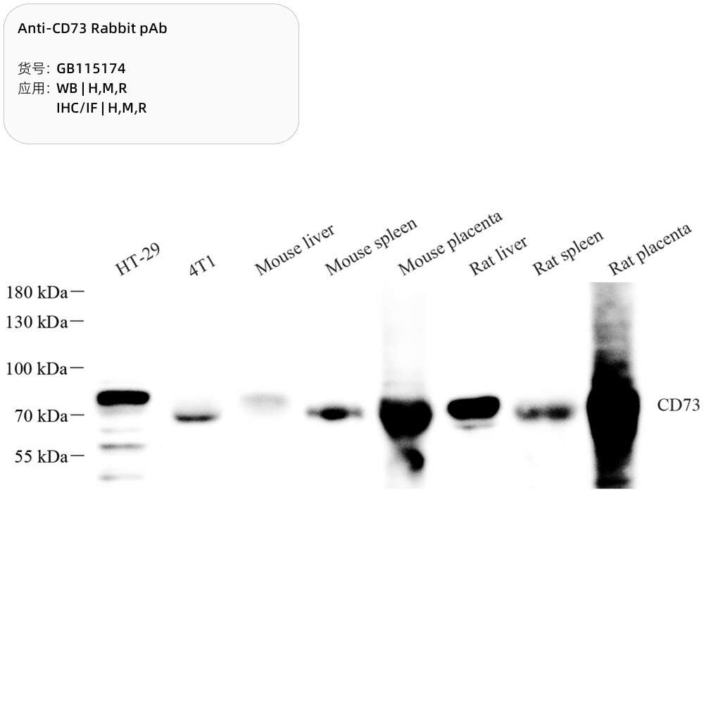 抗CD73兔pAb抗体,适用WB/IHC/IF,能量代谢/Treg/免疫推荐抗体热卖