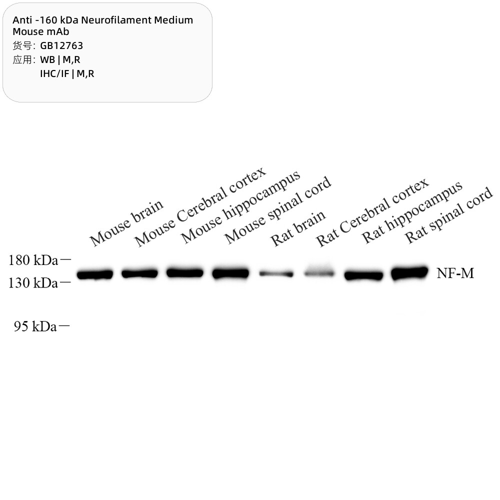 Servicebio抗-160 kDa神经丝培养基小鼠单克隆抗体,适用WB/IHC/IF