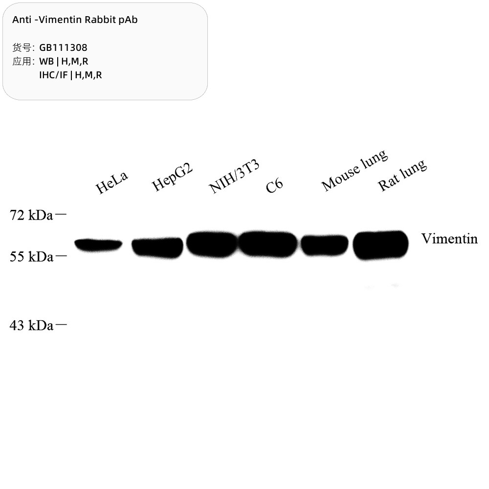抗维门汀兔pAb抗体,Anti-Vimentin Rabbit pAb,适用WB/IHC/IF推荐