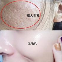 Dont squeeze let me suck it expel the dirt remove the garbage from the pores of the face buy 2 and get 1 free.