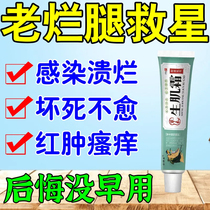 Diabetic foot diabetic foot rotten foot old rotten leg wound becomes more inflamed pus leaks flesh grows scabs quickly saprophysis and muscle growth are quickly removed