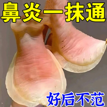 Special cream for root removal of allergic rhinitis special cream for sneezing and stuffy nose