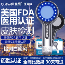Queyue Woods lamp vitiligo detection household medical skin Corwoods lamp detector cat tinea rechargeable model