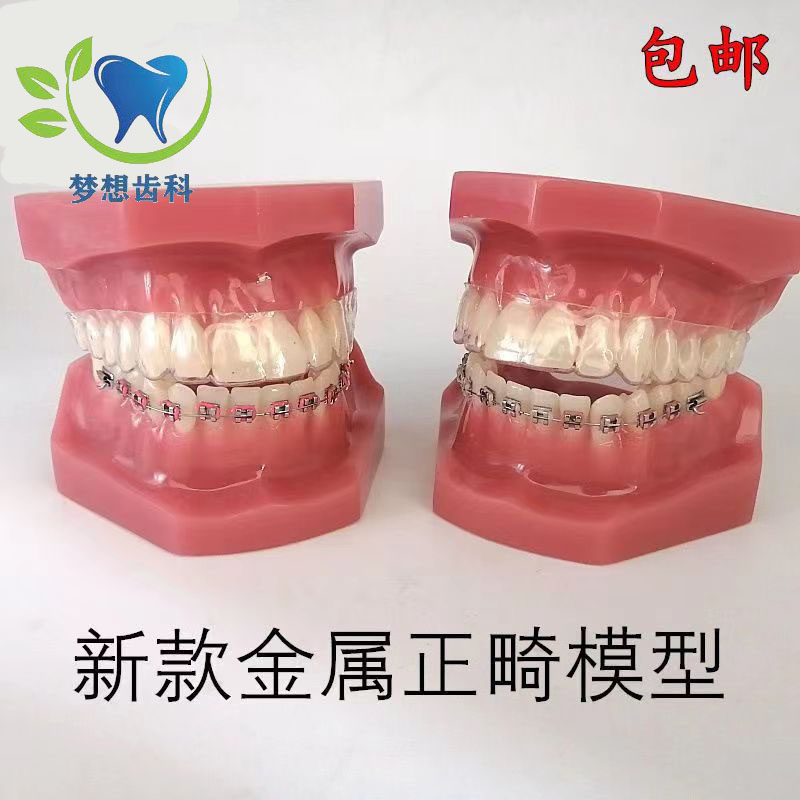 牙科口腔教学模型 隐形正畸矫正模型 金属正畸模型 口腔展示模型