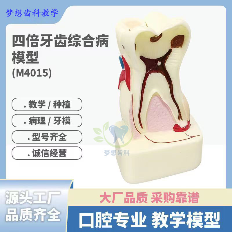 牙齿模型口腔教学综合病模型四倍仿真模具树脂牙周病演示教具摆件