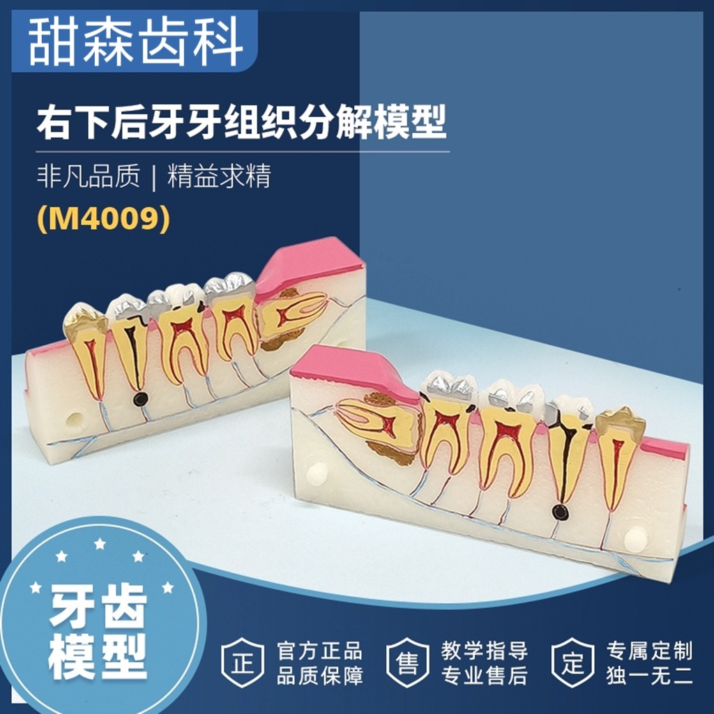 牙齿口腔右下后后牙组织分解模型智齿牙齿解刨口腔讲解可拆分模型