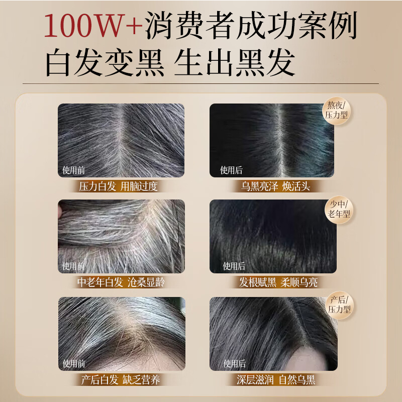 揭开日本最佳洗发水的神秘面纱