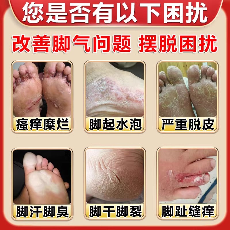 狼毒脚痒水泡型脱皮烂脚丫脚臭去真菌除臭脚汗膏脚气去痒杀菌膏药,彻底告别脚臭脚气,清爽一夏!-护足霜-淘宝好物网