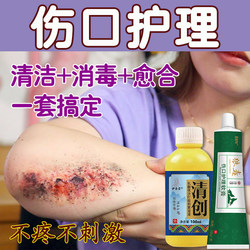 낙상과 피부가 튀는 화상과 두근 구멍 청소 및 소독 상처 관리 연고