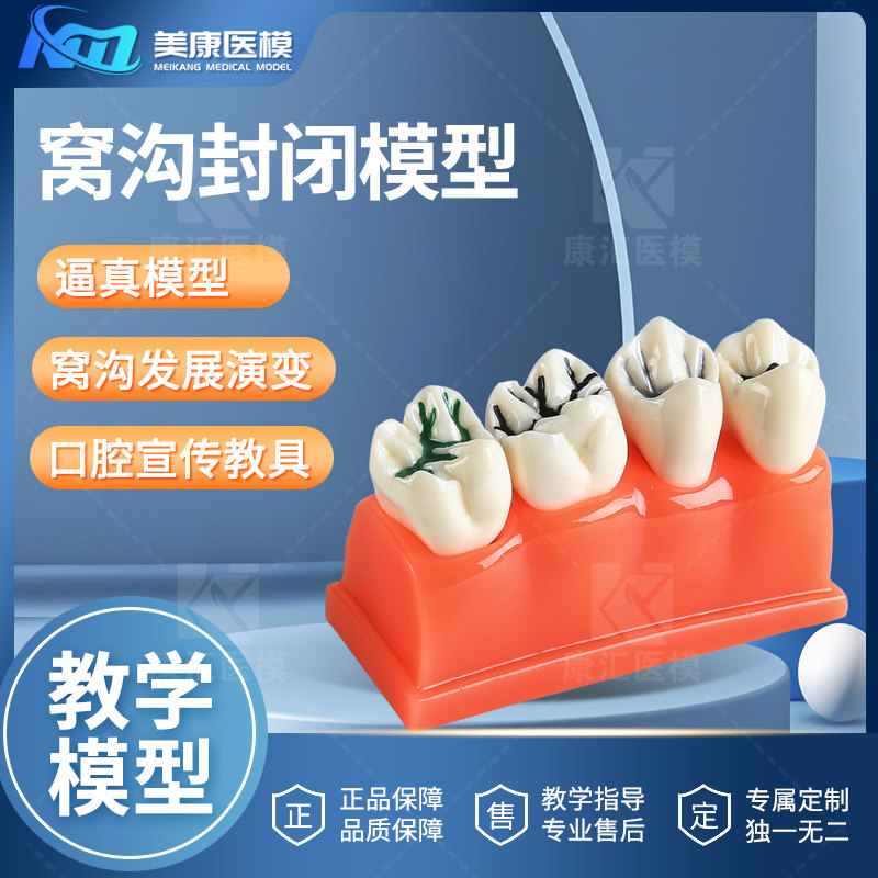窝沟封闭模型口腔教学讲解分解分析教具可拆卸医患沟通全疗程演示