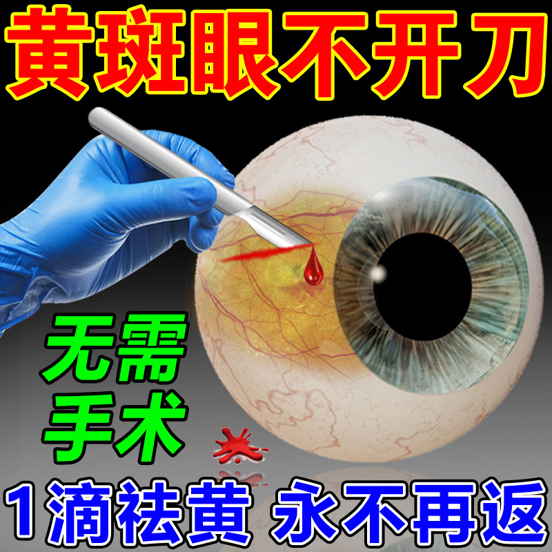 Removal of fundus macular degeneration eye drops eyeball eye white bleeding eyes cloudy dry itchy yellow eye drops