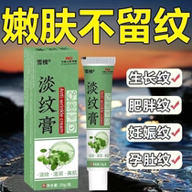 Remove obesity lines growth lines eliminate thigh students repair cream mens and womens legs fade childrens repair cream YN