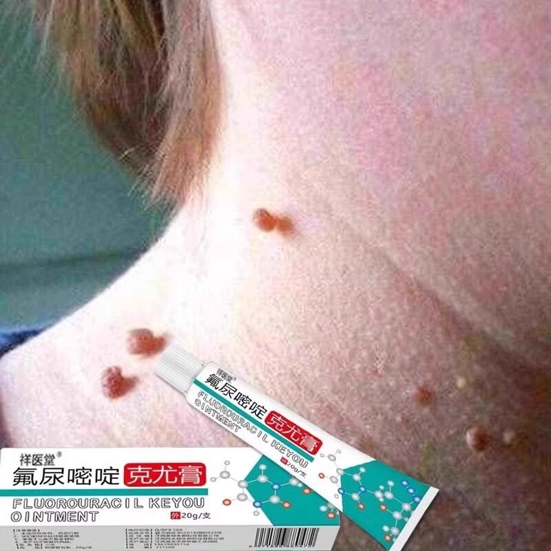 [Горячая распродажа в Douyin] Мясные крупинки для шеи, шеи, лица, рук, ног, головы, подмышек, тела, нежный крем для наружного применения