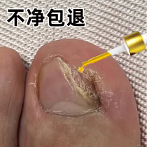 (Tongrentang hot sale) Replace potassium painlessly enjoy a good nail life and turn bad nails into good ones. Just put one drop in the morning and evening.