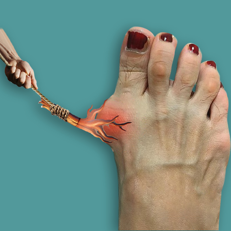 Thumb Valgus paste to cure large footed bone toe aligner hallux valgus trombone valgus correction post-Taobao